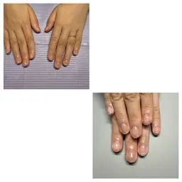 深爪予防・美爪育成(クリアジェル)