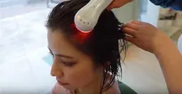 期間限定ミニモ価格/幹細胞培養液とポレーションを使用した髪育プログラムで髪と頭皮のコンディションを整え健康な髪に導く育毛