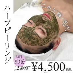 【ニキビケア】人気No.1☆ハーブピーリング🌿にきび・にきび跡・毛穴に！¥15,000→¥4,500