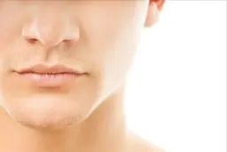 5名様限定★お試し特別価格【メンズヒゲ脱毛】