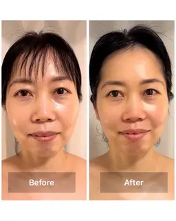 《大人気！限定５名様》【小顔・たるみケア体験 45分】（12月26日まで）