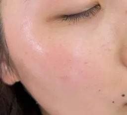 フェイスWAX脱毛(3種から選べるパック付)