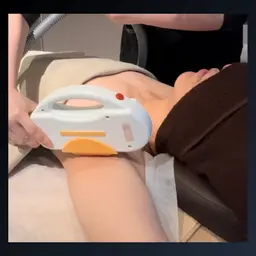 腕脱毛（半袖から見える部位を脱毛）