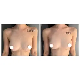 バストケア⭐️