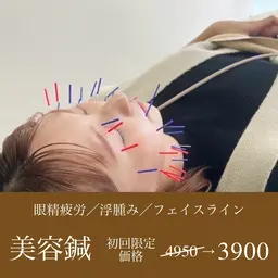 【新規】美容鍼➕パルス電気鍼でむくみ解消スッキリプログラム✨(院内限定特典あり)