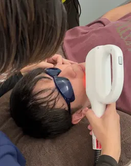 メンズ顔脱毛