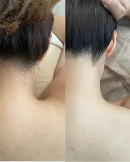 ✨首筋美人✨うなじWax脱毛