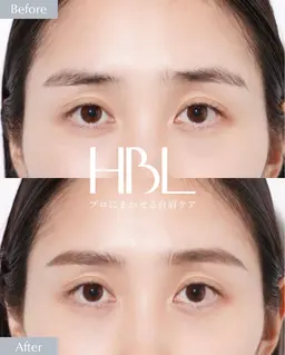 🌸【女性限定】はじめてのHBL(Waxなし)