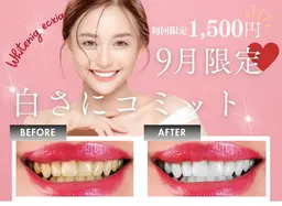 【8月&9月限定🌟エリア最安値!!】強力セルフホワイトニング30分初回体験 ¥7980→¥1500