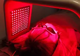 minimo限定メニュー《モニター募集》小顔リフト美容鍼+LED 4回コース ¥60,800 → ¥16,000