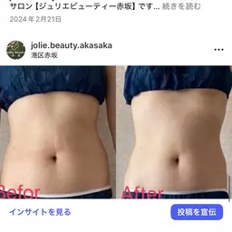 ＼インディバかけ放題60分／疲労回復＆術後ケアOK｜深部から巡りを整えてリフレッシュ✨