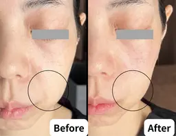 初心者OK★温感ケア＆炭酸パックでうるツヤフェイシャル（60分）