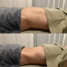 【撮影協力＋口コミ投稿してくれる方】ウエストすっきり◎お腹痩せダイエット🩷1回で変化実感！HOT腸もみと骨盤調整50分