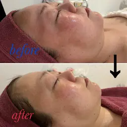 🌿陶肌トリートメント🌿通常2g