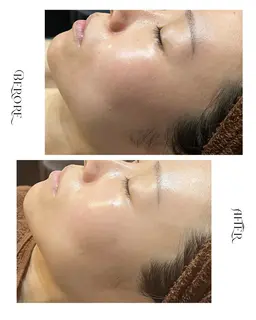 《ツヤ｜潤いたっぷり美肌》艶肌ワックス＋水光ピーリング