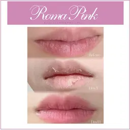 ローマピンク👄くすみを落としてナチュラルピンクに✨