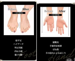 リムーブロックスタイル　ハンド