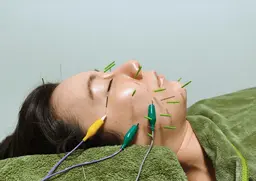 《11月残り3名/鏡を見るたび気になるたるみ/ほうれい線に》リフト美容鍼+LED