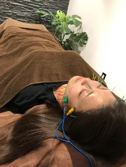 まずは美容鍼をやってみたい！そんな方は電気を流す美容鍼ベーシック⚡️
