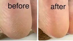 あしうらふわふわケア🦶✨
