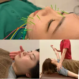 【美肌&疲労回復】美容鍼灸+身体の鍼灸でWアプローチ！（眼精疲労・肩こり）