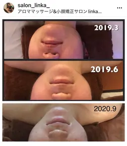 🌻コルギデビュー🌻メイクそのまま、服も着たままOKの韓国式コルギ〈頭蓋骨コルギ付〉30分