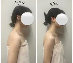 人気No. 1【韓国エステ】コルギ（全顔＋デコルテ）¥11,000→¥3,980