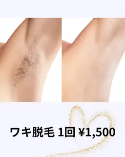 ワキ脱毛