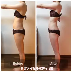 【身体がひとまわり引き締まる‼️】筋膜リリース美容矯正リンパなどの融合技💪リヴァイセルボディ　90分