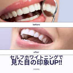 ブライダル☆🦷歯磨き不要☆セルフホワイトニング60分¥4980