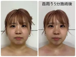 【✨1番オススメのクーポン✨】肩周り集中ケア○全てのケアはここから○顔周りがスッキリメニュー○