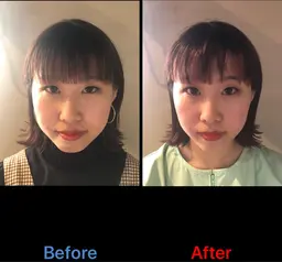 ⭐️小顔コース⭐️美容鍼+パイラソード