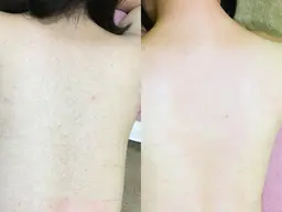 うなじ＋背中