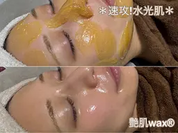 ミニモ限定‼️話題の艶肌wax[フェイスワックス］通常全顔2周を1周で艶肌waxをお試し頂ける限定メニューです💁‍♀️