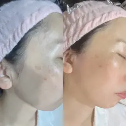🩵艶ぷるハニーフェイスWAX🩵※毛穴引き締めCIKAパック付き