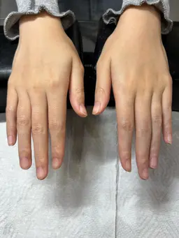 ハンドオフのみ（ケアなし）
