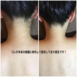 🍁選べる好きな5箇所💖1回¥5000💫箇所は説明文に載せてます💖自己処理無しでご来店ok🥰❣️