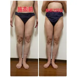 🌻ミニモ限定🌻脚痩せコース60分