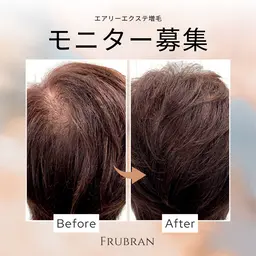 モニターモデル♪薄毛の悩みに!気軽にエクステ増毛体験♪ヘアカラーやパーマokでその日からふんわりボリュームUP