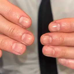 自爪風クリアネイル