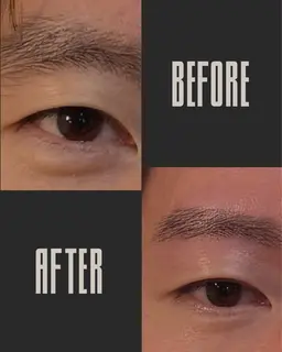 【男性限定】Wax脱毛