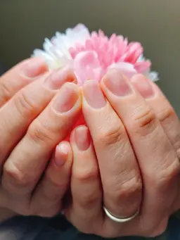 自爪風補強のみ