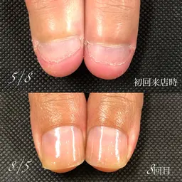 お試し『最強のネイルケア』