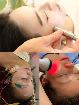 人気急上昇🌟最強セット💎ダーマ鍼+幹細胞エレポ導入&美容鍼💎お肌数万箇所に穴をあけお肌再生力up!最強美容鍼