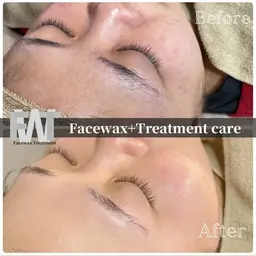 💆🏻♀️産毛ケア×美肌🍯ちゅるんたまご肌へ🥚 『潤艶WAX®』産毛/毛穴/ざらつきに◎ フェイシャルワックス