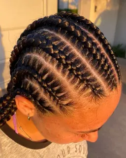 地毛コーンロー　ストレート 2本​〜​