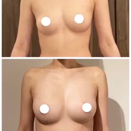【人気No.1】小胸悩みさん専用◎2カップUPを目指すバストアップ上半身体験（施術45分）33000→9900