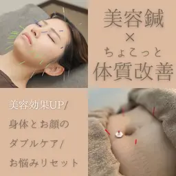 【美容鍼の効果UP⁉︎美容鍼×ちょこっと体質改善鍼灸40分🎶】 お肌のお悩み解消/自律神経を整える/睡眠の質向上🌈