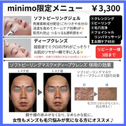 【毛穴汚れごっそりツルツル】ピーリング&毛穴洗浄モニター