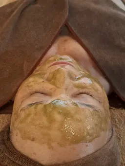 【美容鍼×ハーブピーリング🌿】ハリ艶肌✨引き締め小顔フェイシャル💆デコルテ首肩リンパ付】